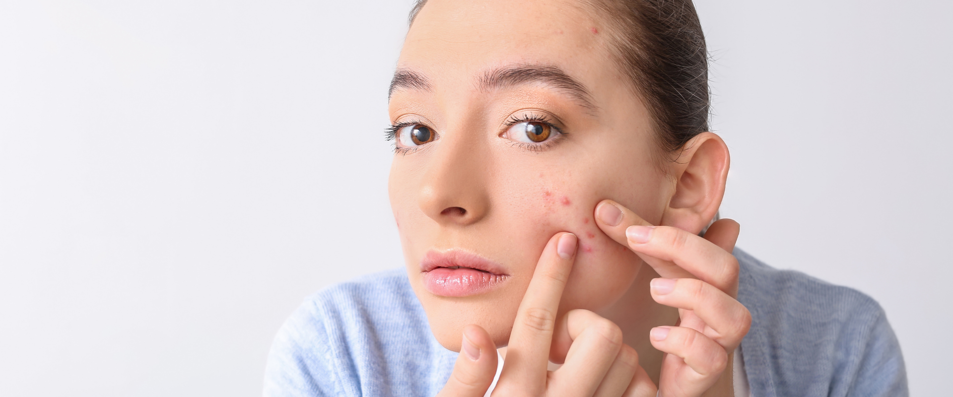 Understanding Skin Discoloration: Causes and Cures